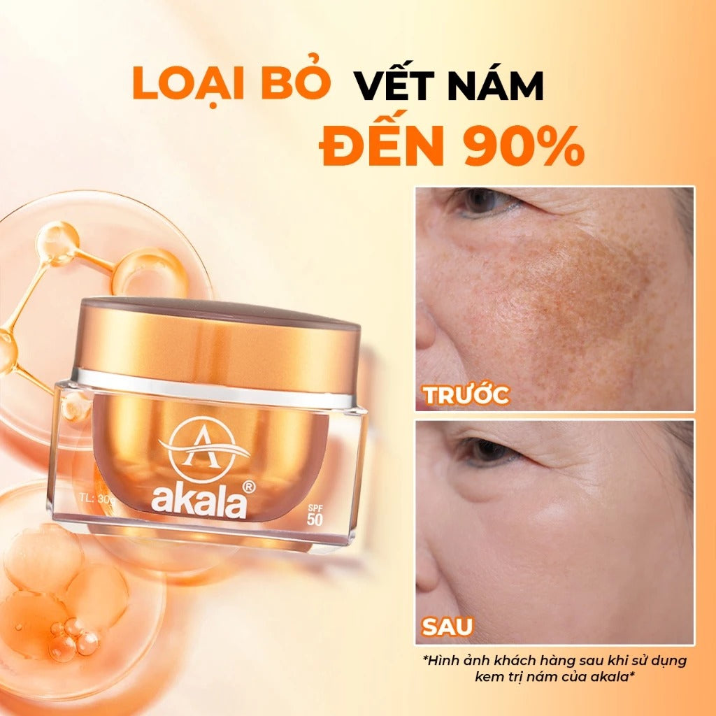 01 Box -  Kem Nám - Tàn Nhang - Đồi Mồi - Chống Lão Hoá akala ( Tế Bào Mầm Tái Sinh & Collagen Peptide ) 30gram