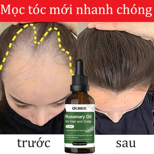 Serum mọc tóc tinh dầu mọc tóc Tinh chất mọc tóc Tinh Chất Chống Rụng Tóc Kích thích tóc mọc nhanh và giảm rụng tócnh 50ml