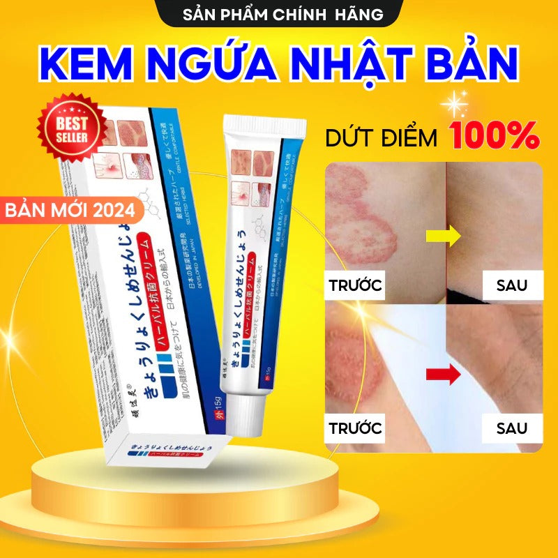 02 bottles - Kem Bôi Viêm Da Cơ Địa NHẬT BẢN Hỗ Trợ Dứt Điểm Lác Đồng Tiền, Nấm Da Đầu, Ghẻ Nước, Á Sừng Cực Kì Hiệu Quả